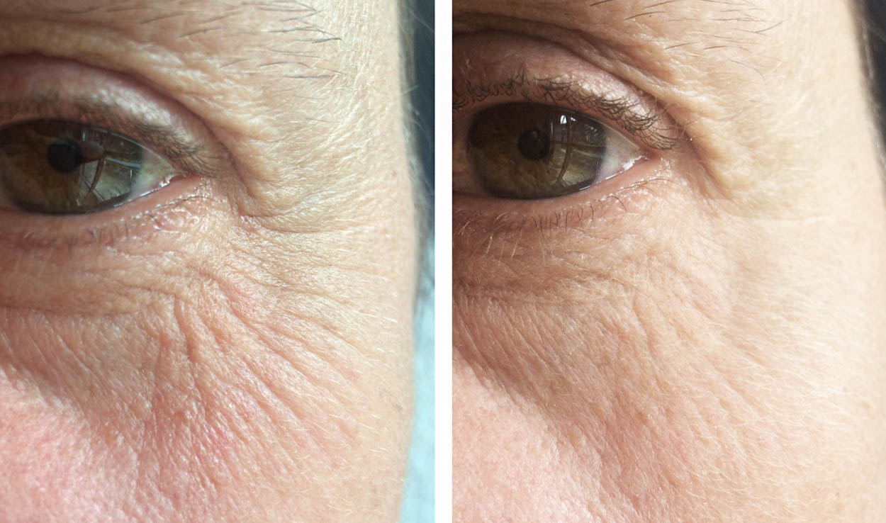 Poudre Précieuse von Larune - Der sofort Liftingeffekt - ID13993_03.jpg?v=1566310420