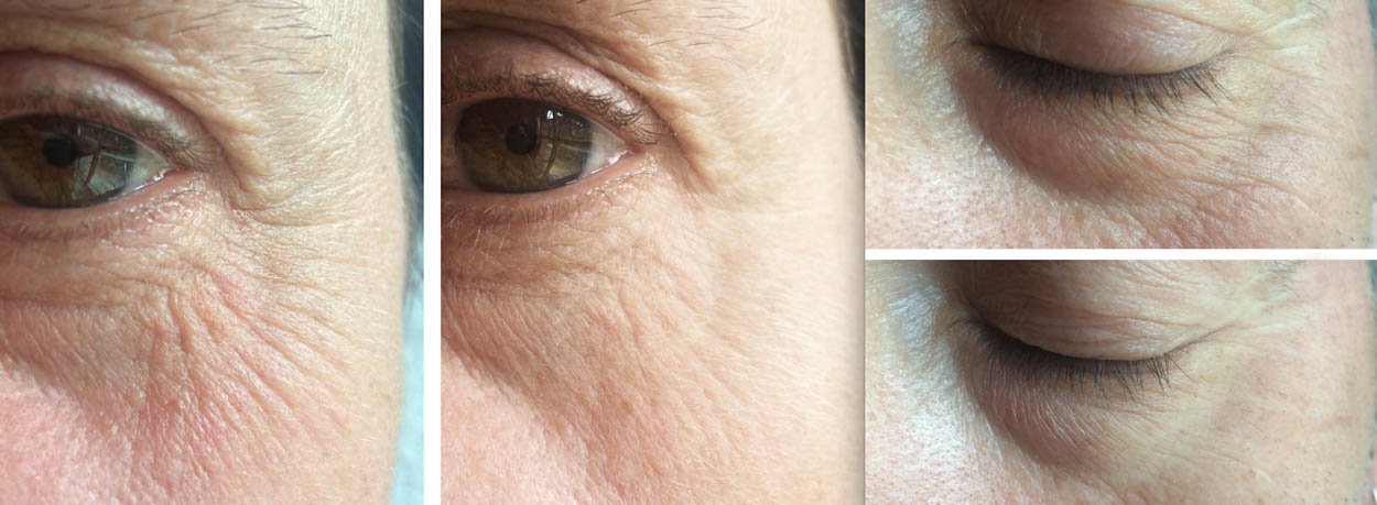 Poudre Précieuse von Larune - Der sofort Liftingeffekt - ID13993_04.jpg?v=1566310420