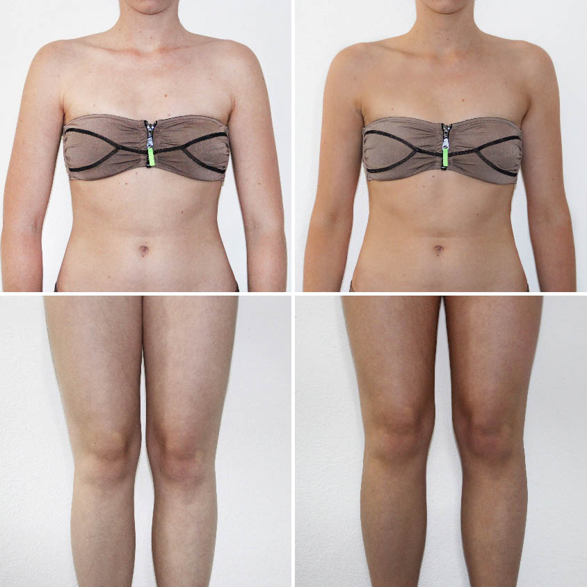 Auto-bronzant, j’y vais ou j’y vais pas ?! - ID13994_04.jpg?v=1566310420