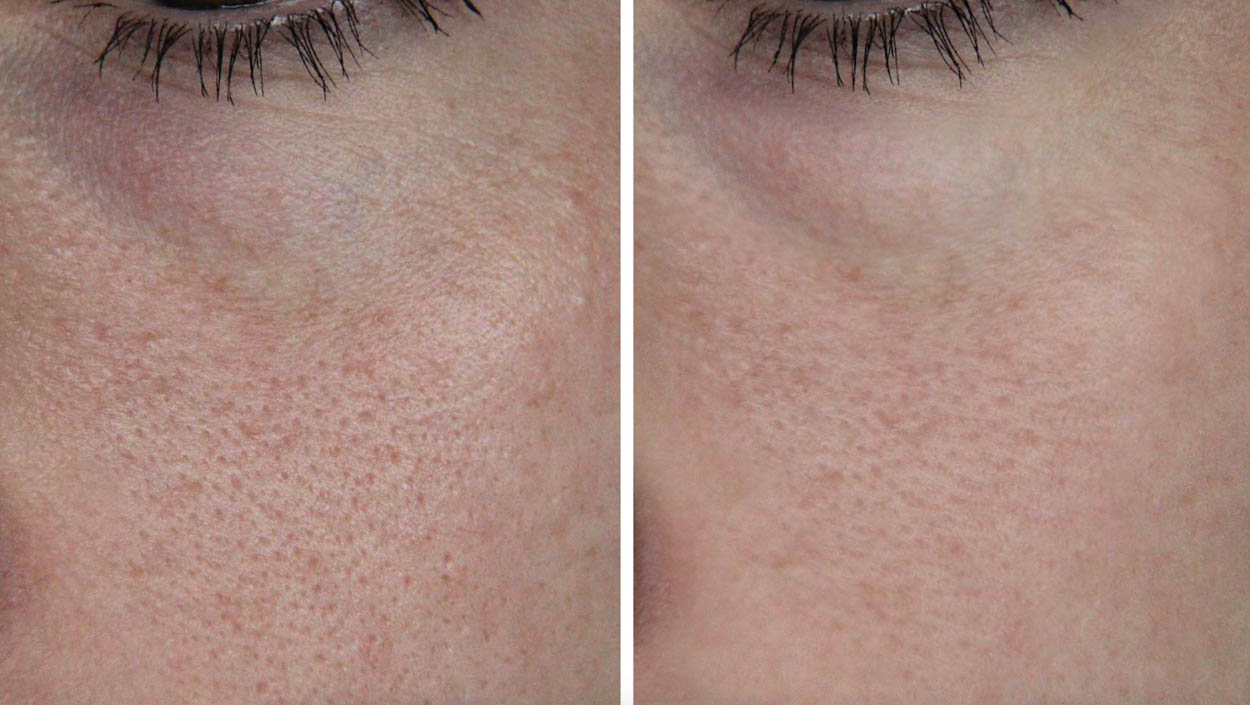 Porenroutine - ID14136_02.jpg?v=1566310425