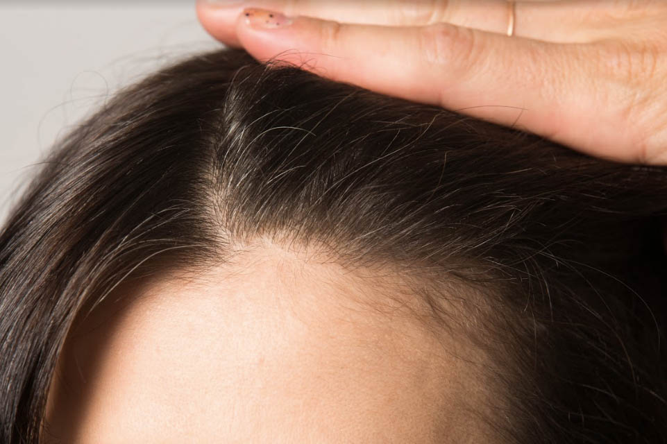 weisse haare abdecken ohne zu farben